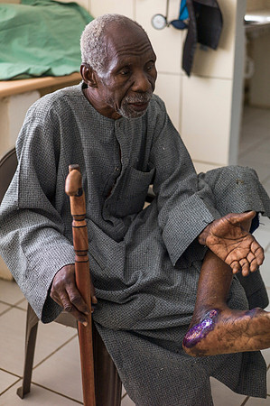 Life and medical aid in Buniadu, The Gambia, by Angelika Berndt photography.