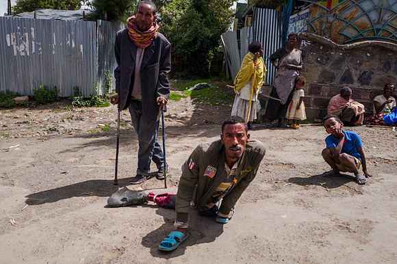 Live on the edge of society in Dessie, Ethiopia.