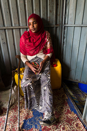 Live on the edge of society in Dessie, Ethiopia.