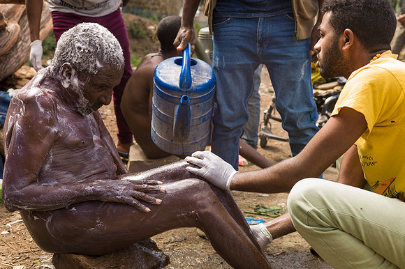 Live on the edge of society in Dessie, Ethiopia.